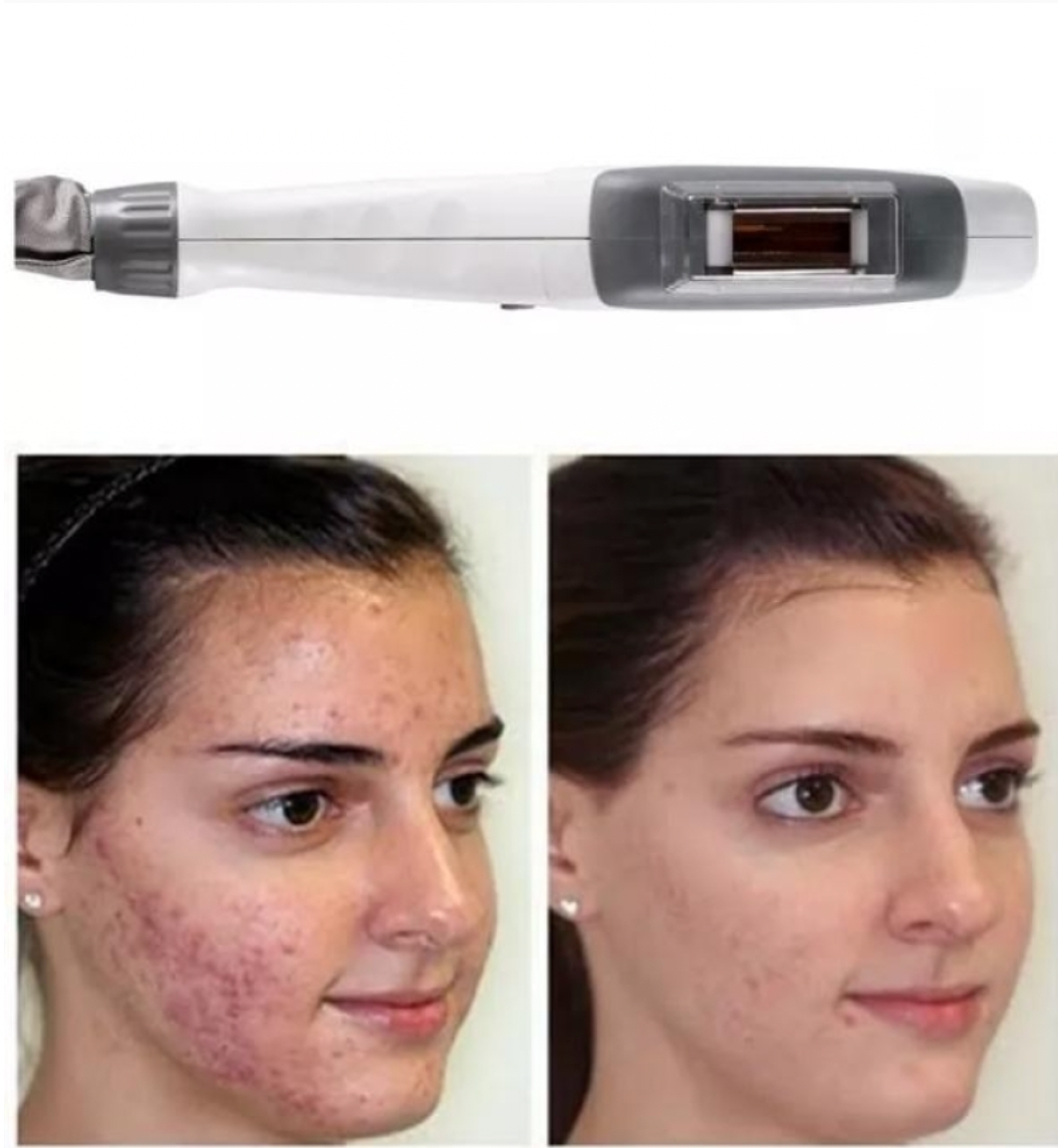 Zemits Light Expert 2.0 IPL Laser Machine